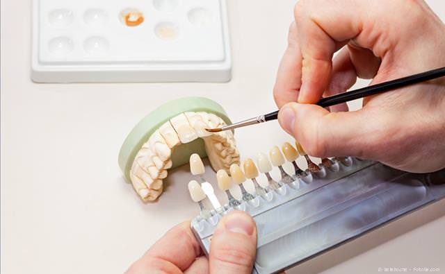 Individuelle Gestaltung von Zahnersatz durch den Zahntechniker